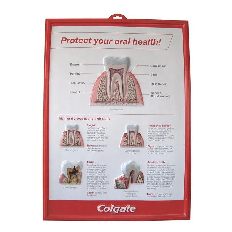 Medicine adverting custom medical charts 3d embossed dental medical poster tooth anatomical model