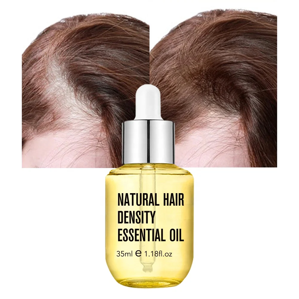 Moisturizing Vegan Hair Growth Oil Serum Natural Hair Growth Oil For Black Women Private Label