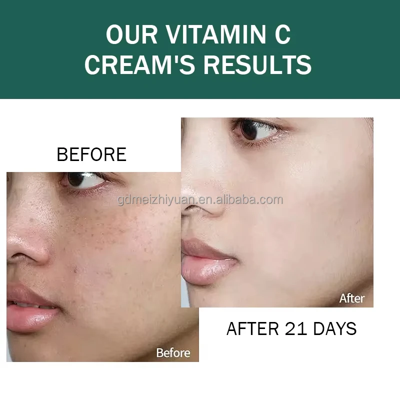 Organic Private Label Pimples And Dark Spot Remover Cream Underarm Cream For Armpit
