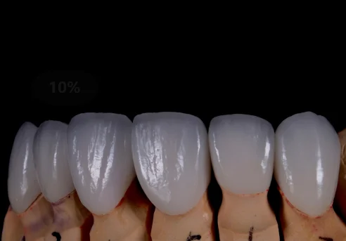 
zirconia crown zirconia teeth zirconia denture 