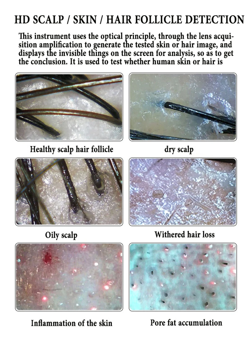 Meiboyi Skin Analysis Machine Scalp Camera by Simple operation of four-spectrum scalp skin detector analyzer For Beauty Home