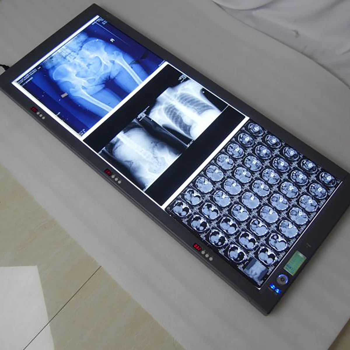 
Hot Sale Medical LED X-ray Film Viewer Triptych Viewing Light MSLZG3C 