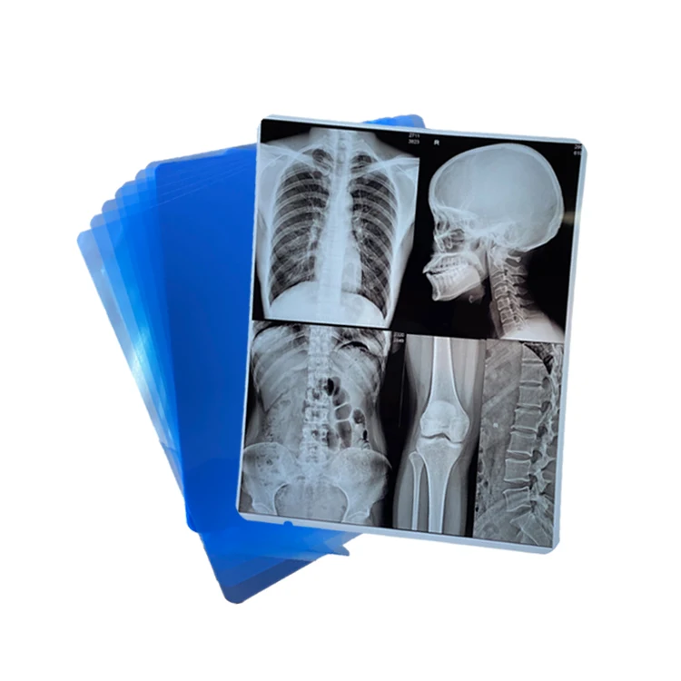 280mic waterproof digital printing blue x-ray inkjet medical film for radiology imaging