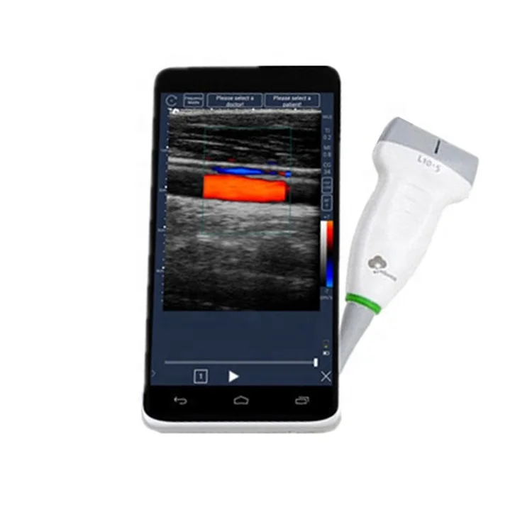 
1280*720 High Resolution Pocket Color Ultrasound Device Mini Handheld WIFI Ultrasound USB Probe 