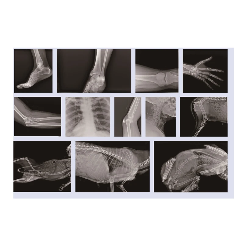 Handheld X-ray Unit Small Digital X Ray Machine all in one DR System With Flat Panel Detector