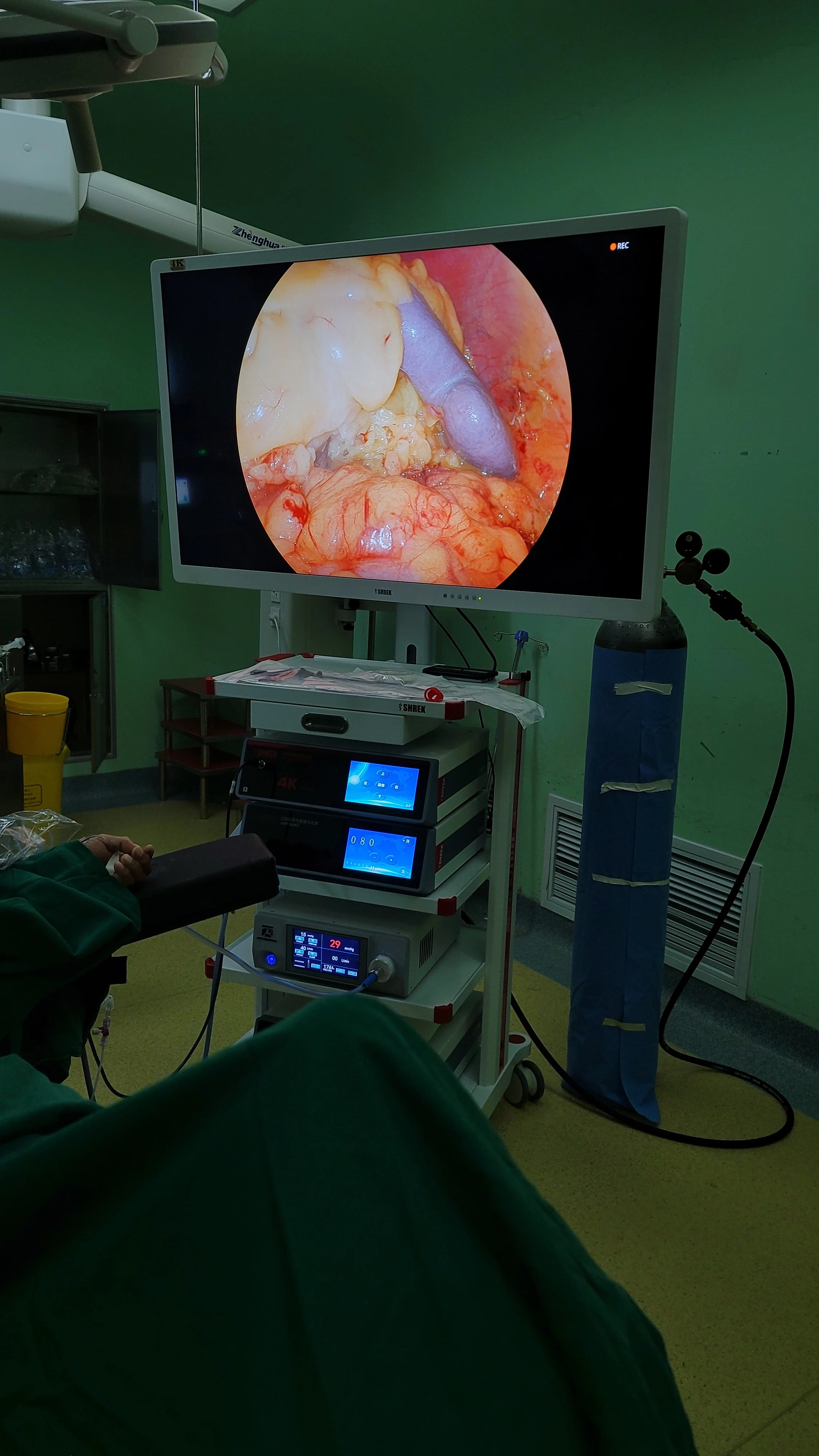 shrek surgical 4k endoscope camera with medic 4k monitor 32 inch