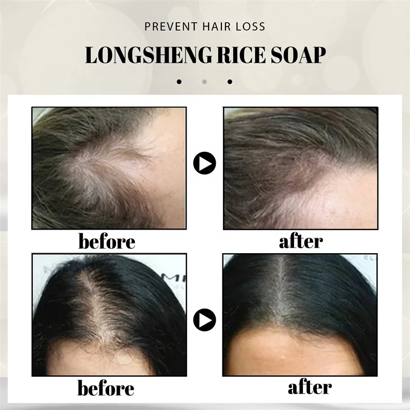 Moisturize Repair Hair/ Hair Growth /Prevent Lost/Anti-Dandruf Polygonum Multiflorum Hair Care Bath Supplies Handmade Soap