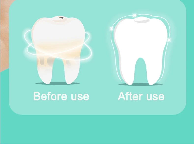 2022 Hot Selling 3 Gear Dental Portable Electronic Ultrasonic Sonic Visual Teeth Whitening For Tartar Remover.jpg