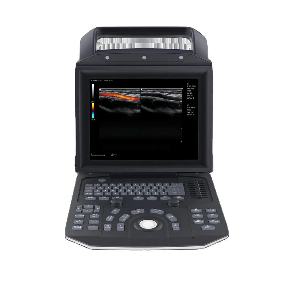 LTUB73 New Model High-end Portable Medical Ultrasound Instruments Color Doppler Ultrasound Machine