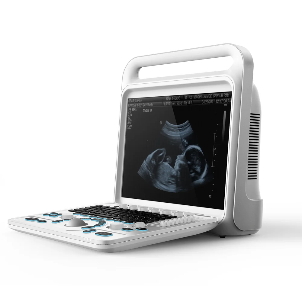 Multi-function ultrasound machine high quality 4D Color doppler ultrasound machine scanner