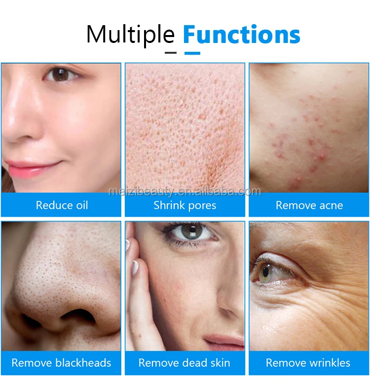 Portable crystal skin peeling microdermabrasion peel machine diamond microdermabrasion machine for salon