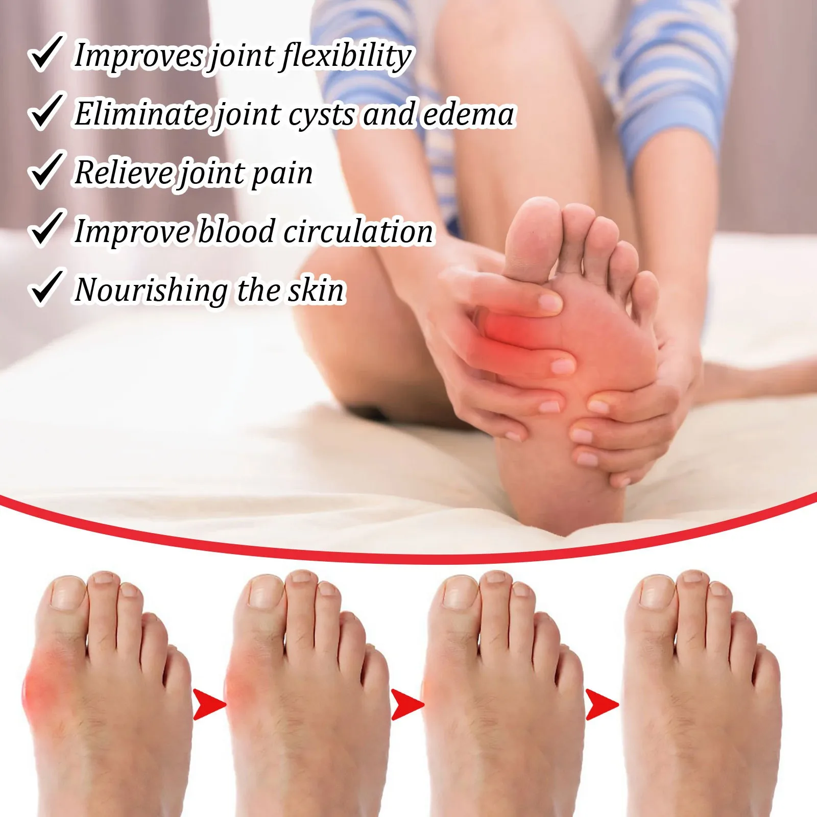 EELHOE High Quality Vegan Ingredients Infection Care Aching Bunion Relief Toe Pain Stiffness Bunion Cream
