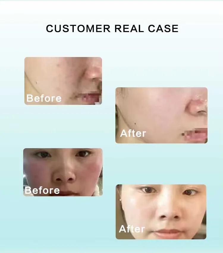 Efficacy case 1