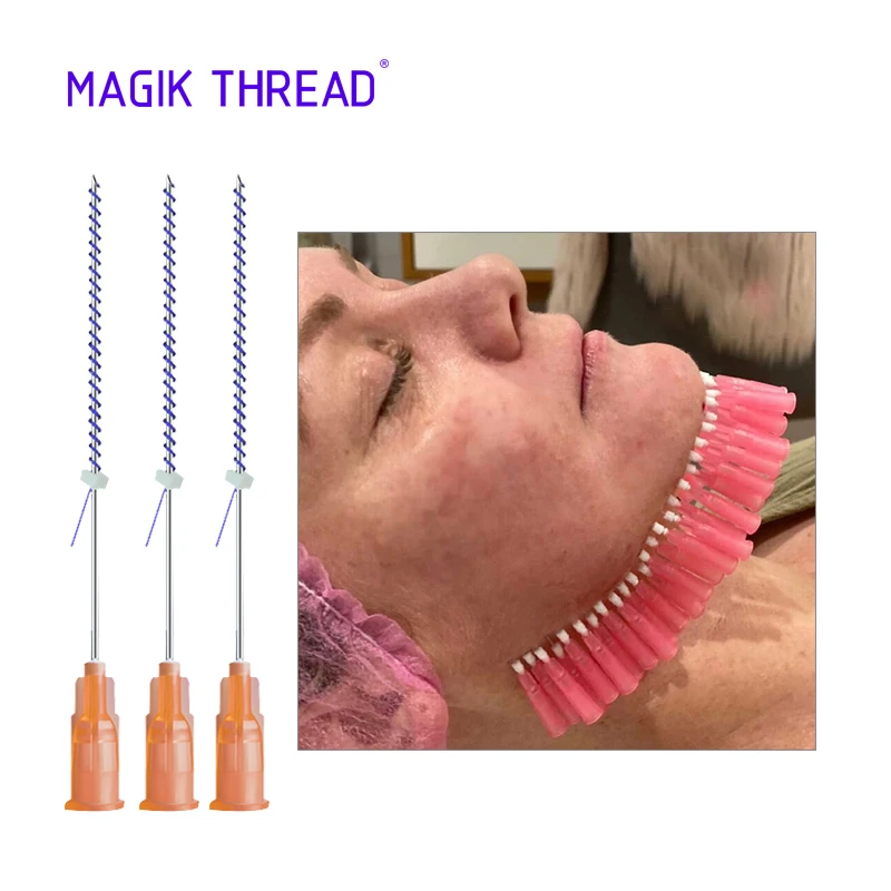  Magik Thread tornado screw pdo 27 г 38 мм подтяжка кожи лица лифтинг Стерильная Двойная резьба