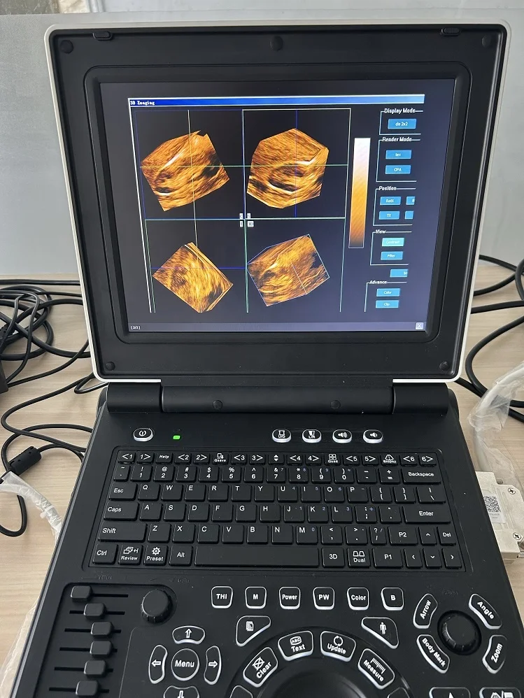 Cheapest Color doppler 3D 4d  obstetric  ultrasound scanner diagnostics scanner for hospitals