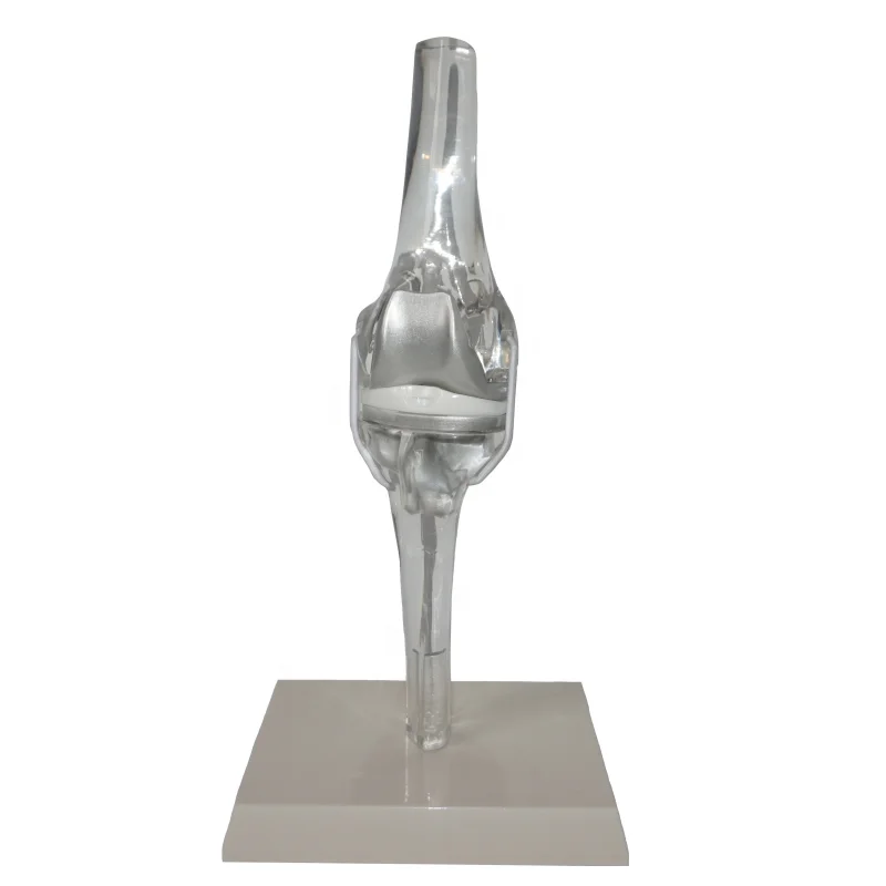 Transparent Knee Joint Replacement Model