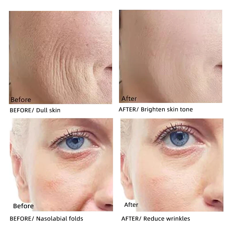 Free Sample Women skin care beauty products bleaching body  face cream lotion skin whitening cream for dark skin