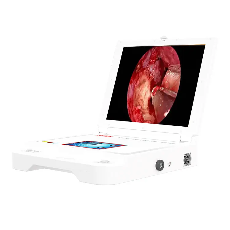 mini medical 17 inch hd endoscope ent camera system