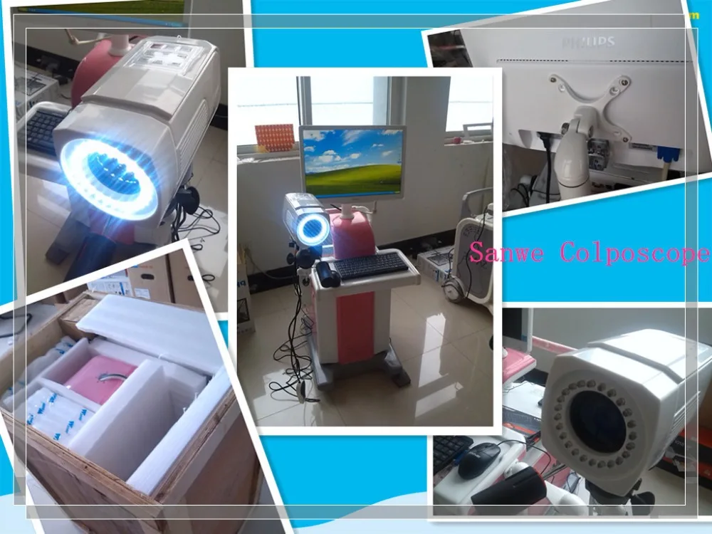 beautiful vagina colposcope/SW-3303 Digital Electronic Colposcope (Trolley-type)