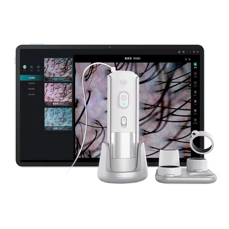 Skin Diagnosis Hair Analyzer Hair Follicle Detector 15.6 Inch 50X 200X Lens Charging Type Scalp Hair Analyser Machine