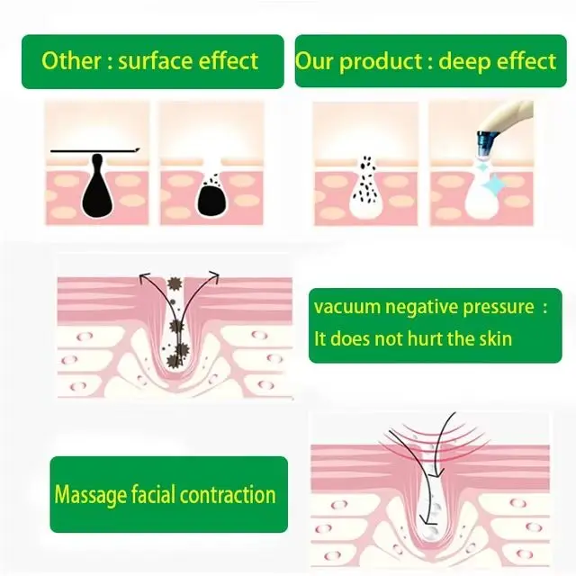 Beauty Personal Care Face Pore Cleaner Suction Skin Care GiftBeauty Tool Deep Cleansing  Nose Face Vacuum Blackhead Remover