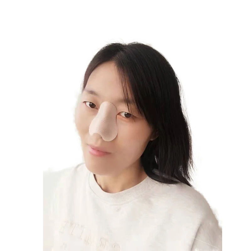 rhinoplasty nose splint.jpg