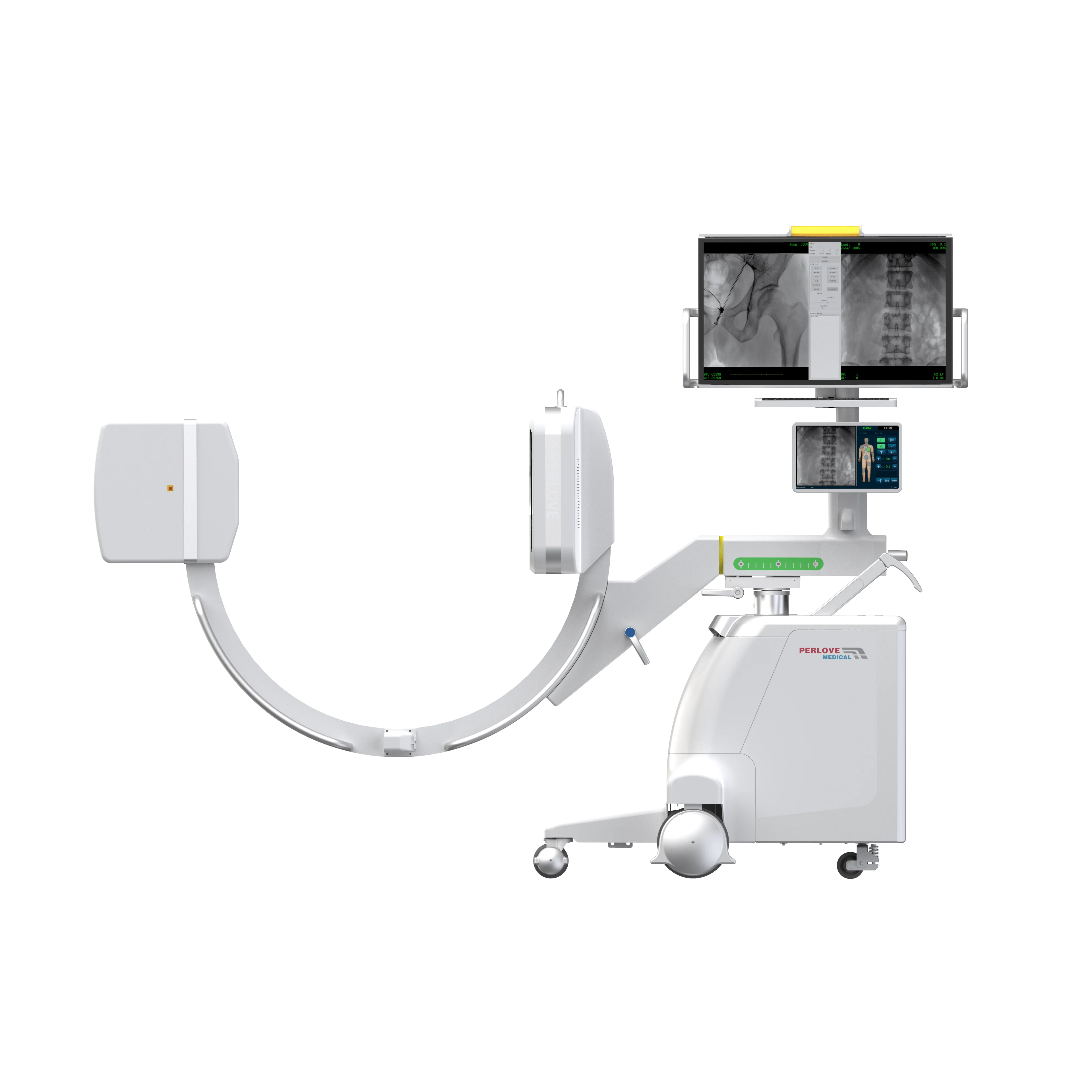 PLX119C Mobile C-arm System with Upgraded FPD