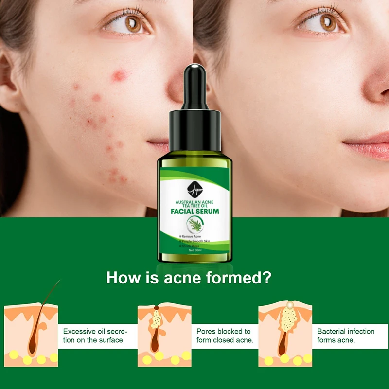 Private Label Organic Natural TEA TREE FACE SERUM For Skin Repair MoisturizingAustralian tea tree loofah essential oil soap