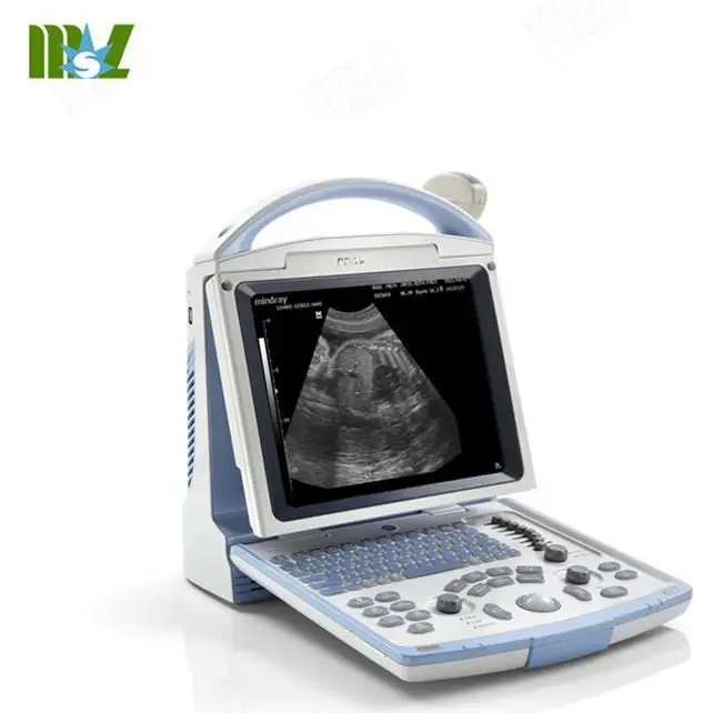 Ergonomic Digital Mindray DP20 Price / Summer Sale!! Portable 12.1 Inch LED Black & White Ultrasound