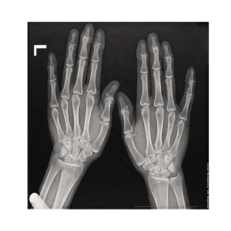 
Thermal dry Xray blue base film for medical imager digital manufactory hospital photosensitive dry film competitive price 