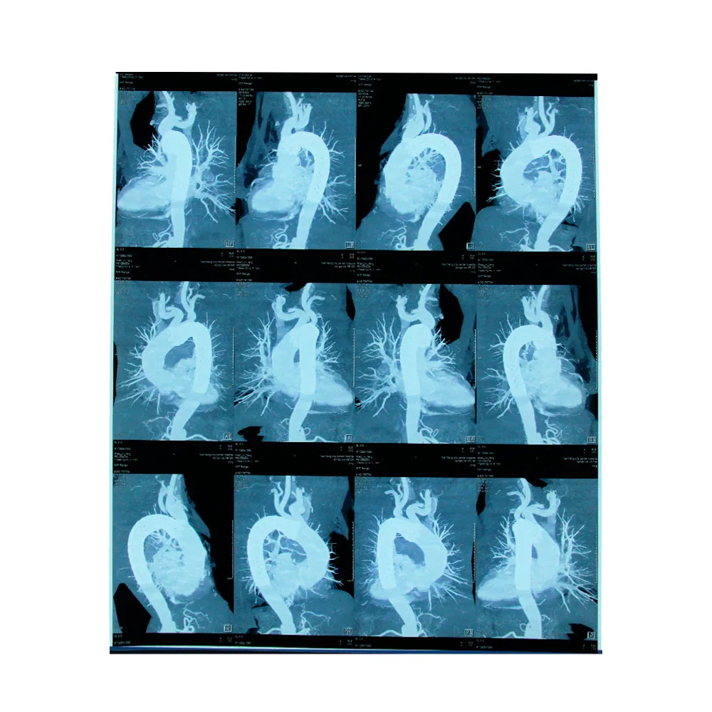 The biggest sales event of CT MR MRI DR film