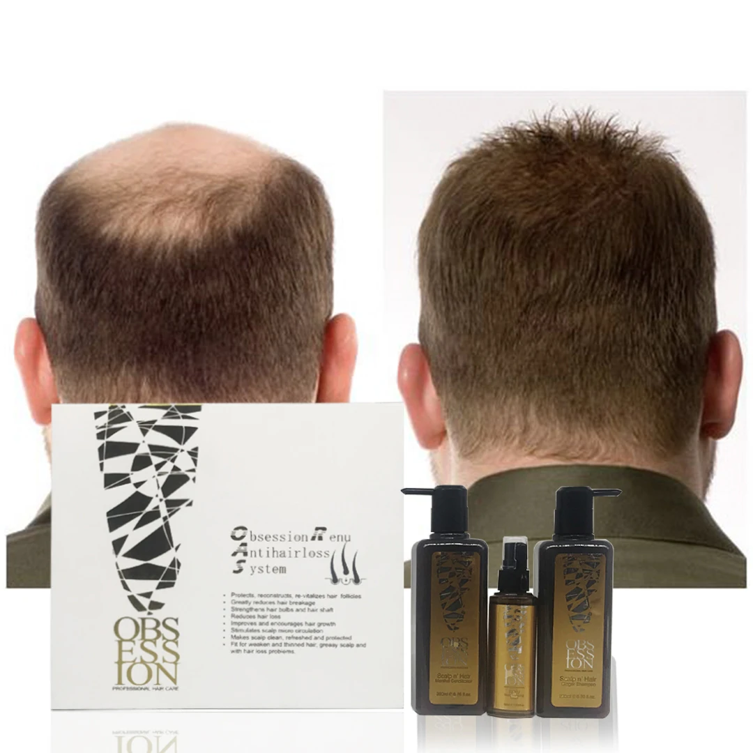 OEM/ODM чистый натуральный Имбирь против выпадения волос, масло для роста волос, частная торговая марка, шампунь-терапия