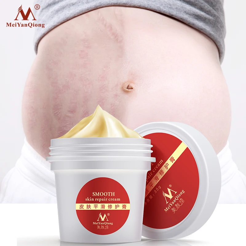 Body Skin Care stretch marks scar removal cream Maternity treatment Anti Vergeture Repair Stretch Mark Cream