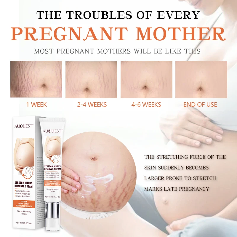 
Private Label Organic Herbal Acne Leg Deep Scar Removal Gel Anti Pregnancy Stretch Mark Removal Repair Cream 