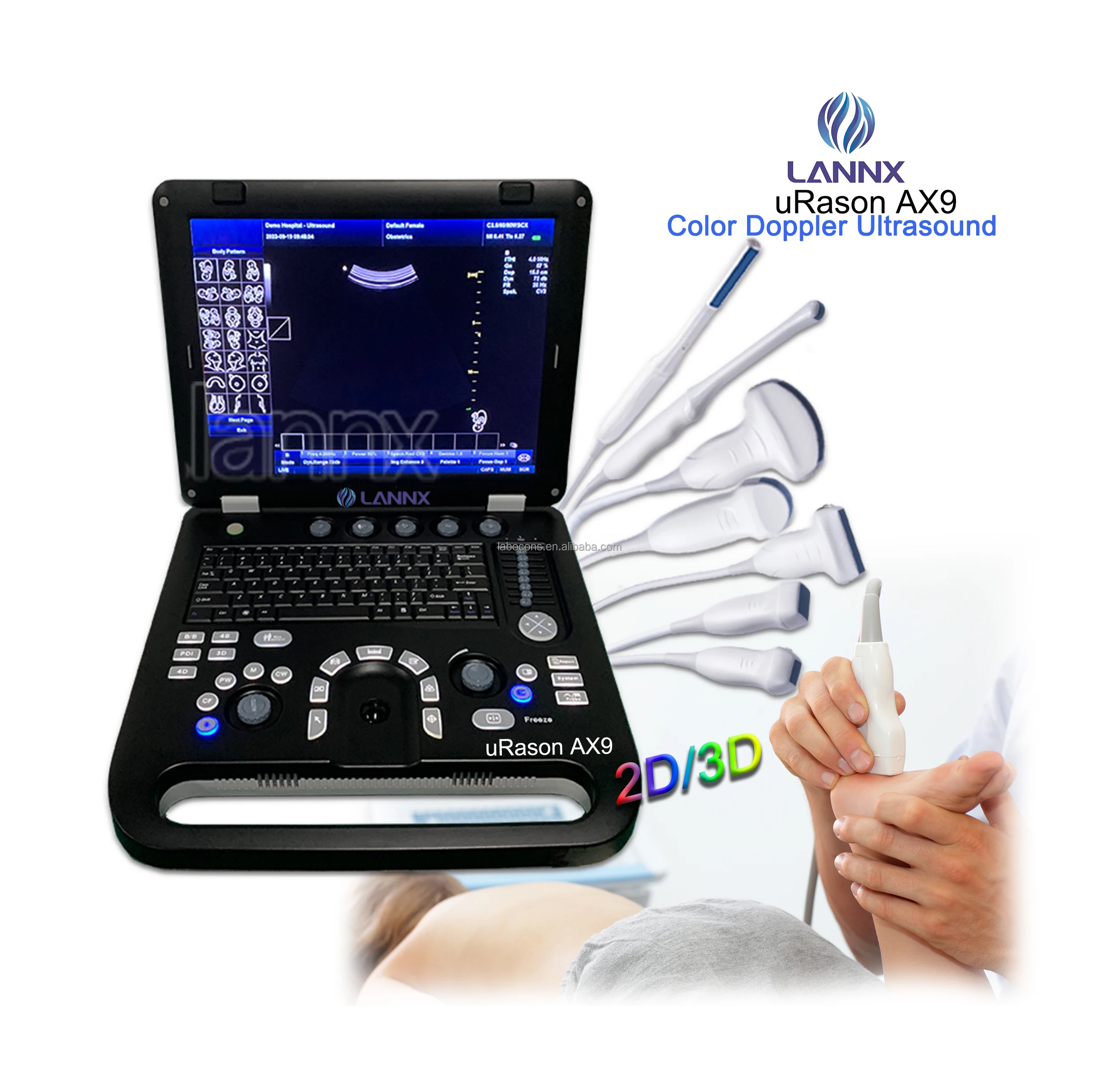 LANNX uRason AX9 Factory Price Medical Instruments Color Doppler Ultrasound Scanner Machine 2d / 3d ultrasonic diagnostic system