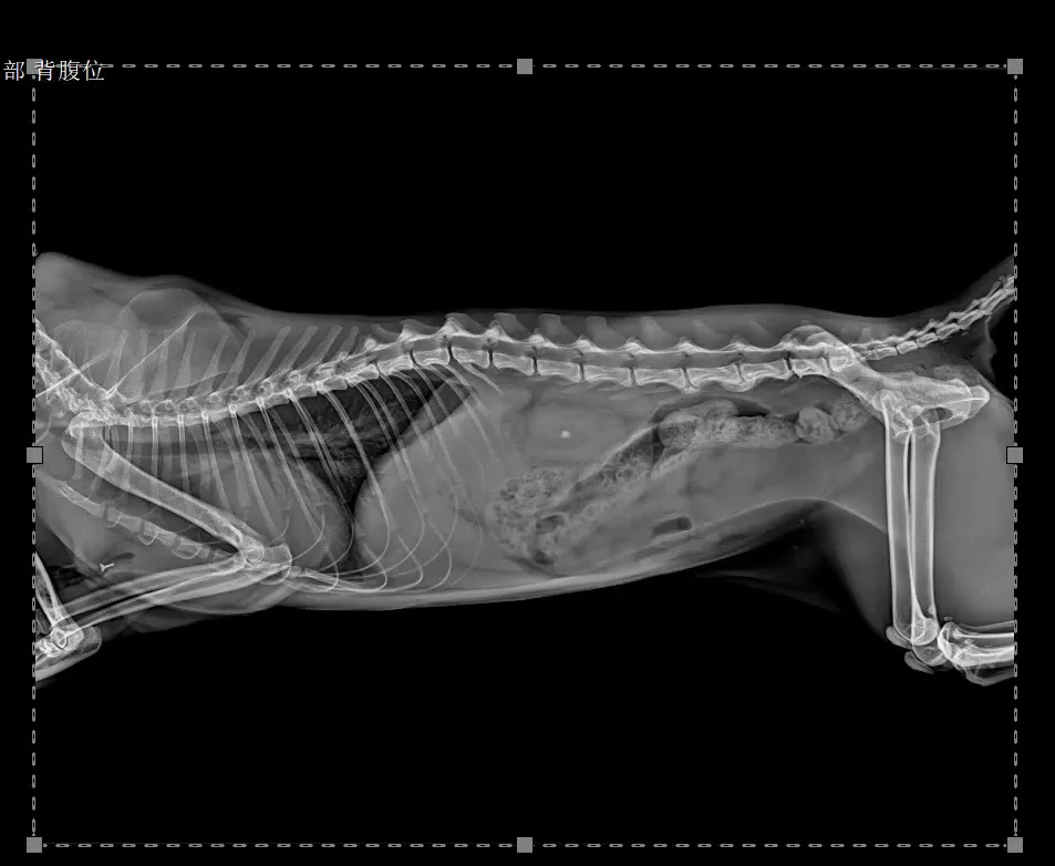 Wired DR Xray Flat Panel Detector for Medical X ray Radiotion Equipment