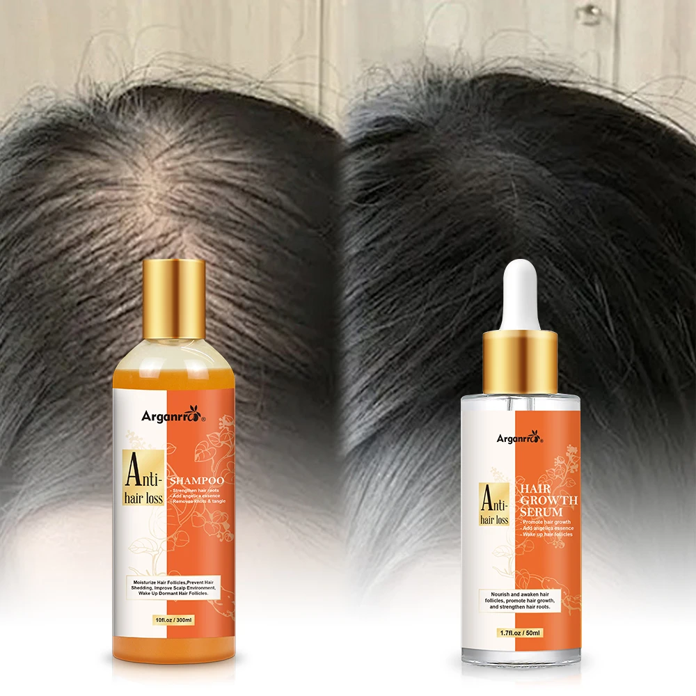 OEM Save Hair Seam Welcome Test Sample Hair Care Set Regrowth Anti LOSS Shampoo And Hair Growth Serum