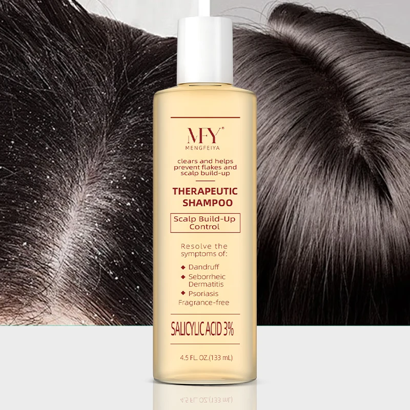 3% salicylic acid anti-dandruff and anti-itch treatment shampoo for seborrheic dermatitis and psoriasis treatment shampoo
