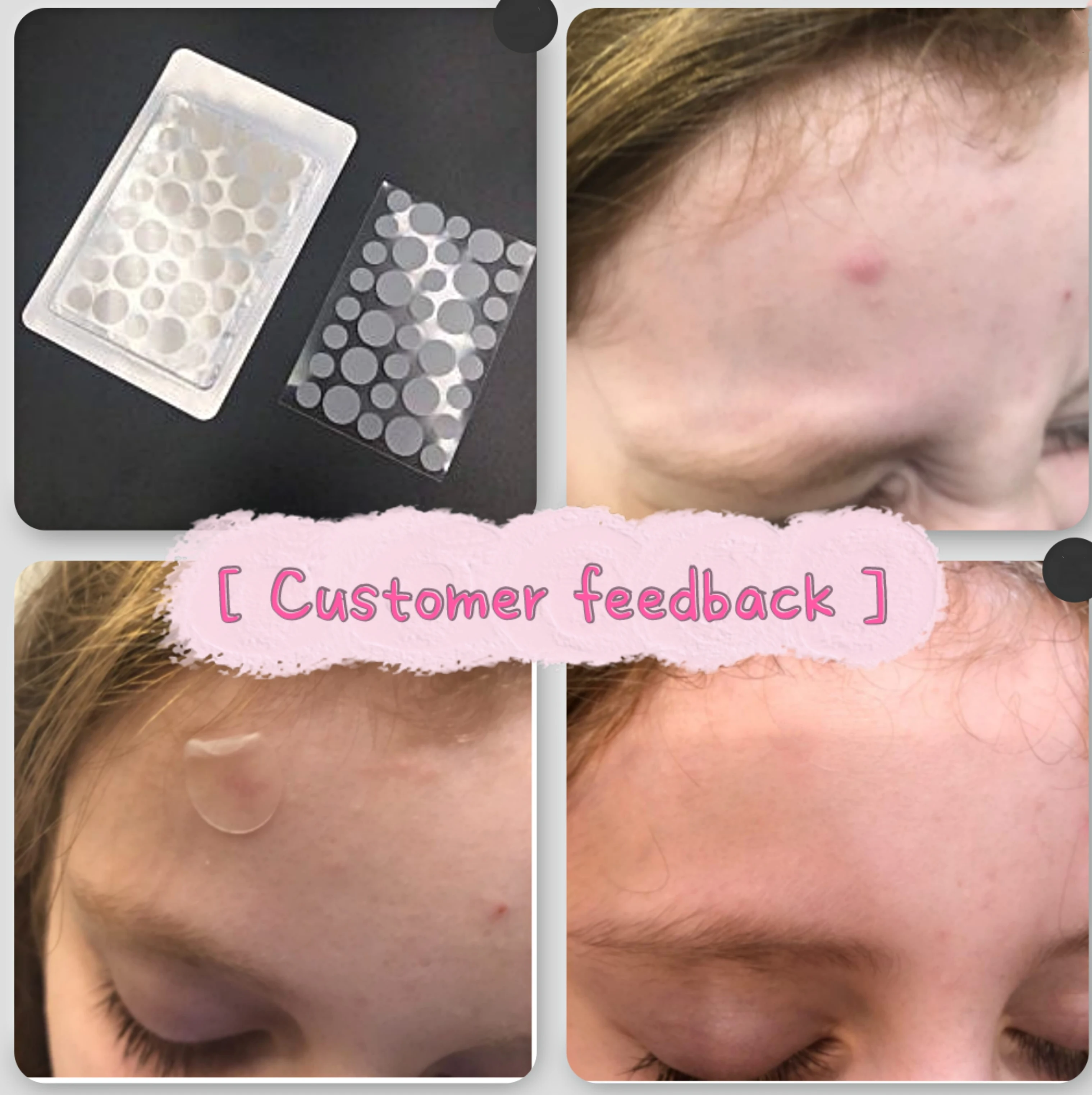Private Label Korean Spot Anti Pimple Patches Cute Hydrocolloid Supplier
