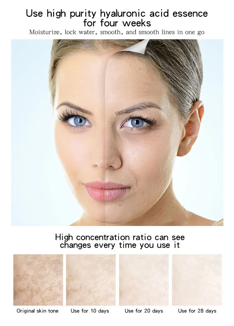 Oem увлажняющая Успокаивающая восстанавливающая сыворотка для ухода за кожей