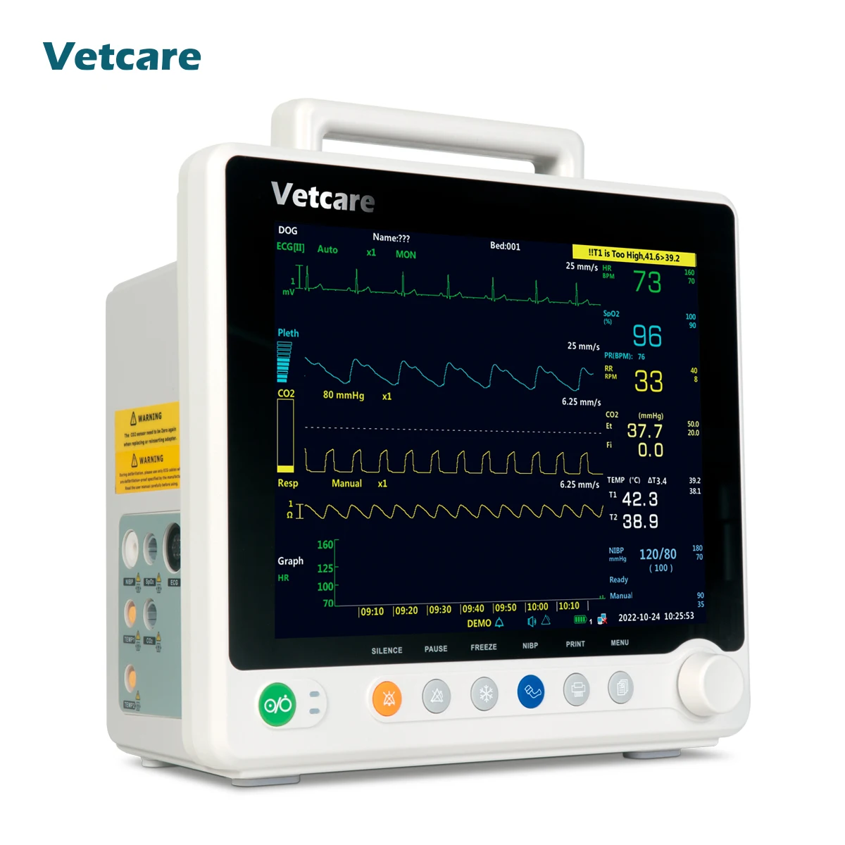 Portable 3-lead 5-lead Pet Electrocardiogram Machine with SPO2 Veterinary Monitor