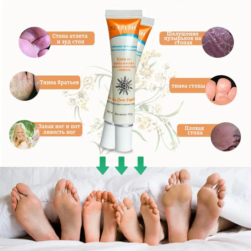 Antiallergic Antipruritic Anti-inflammatory Medicinal Ointment,skin ointment cream