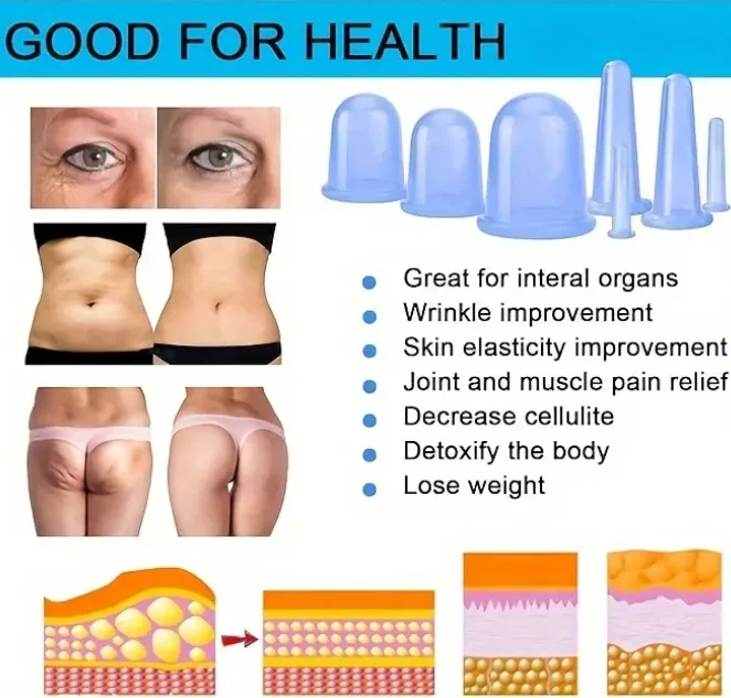 7pcs Silicone Cupping Set, Face Cupping Set for Face and Eyes Cupping Massage, Face Cupping Set Silicone Cup With Peeling Brush