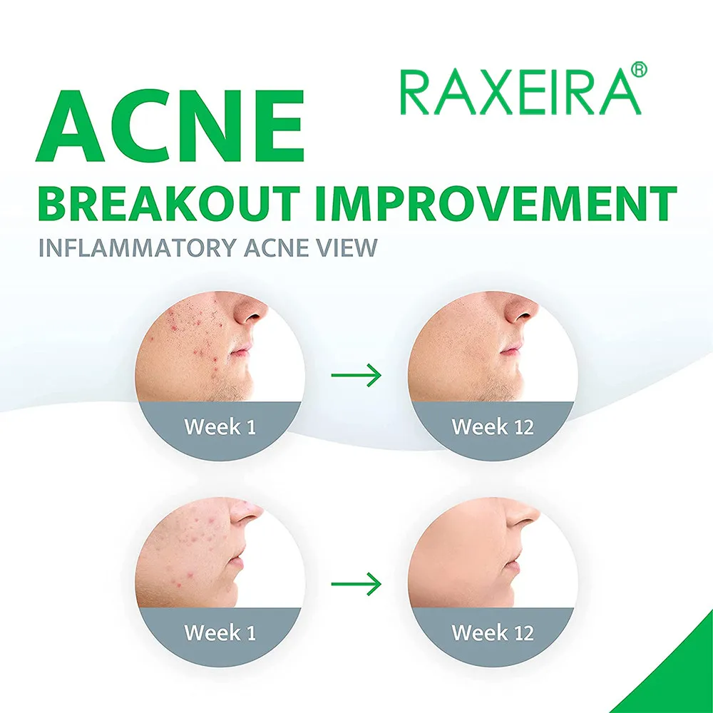 Best Wholesale Herbal Acne Cream Face Care Repair Smooth Skin Shrink Pores Anti Age Acne Treatment Cream For Face Beauty