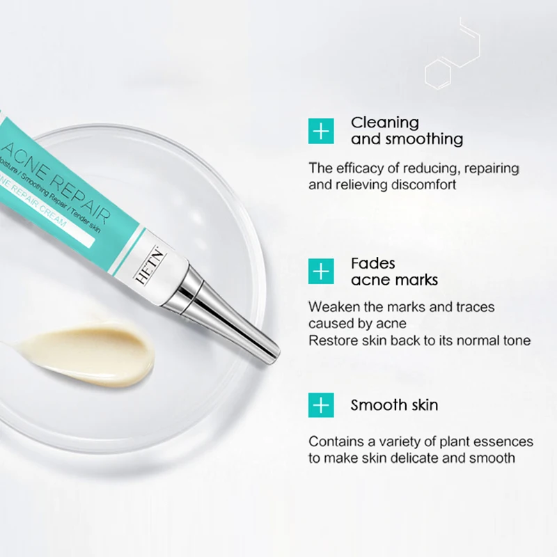 Enhances brightness herbal essence acne scar removal cream deep acne scar removal stretch mark cream oil control anti acne cream