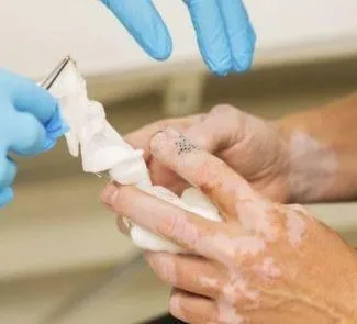 
Safe Benoquin Vitiligo Cream Powder 99% /Monobenzone Whitening Cream 60% 