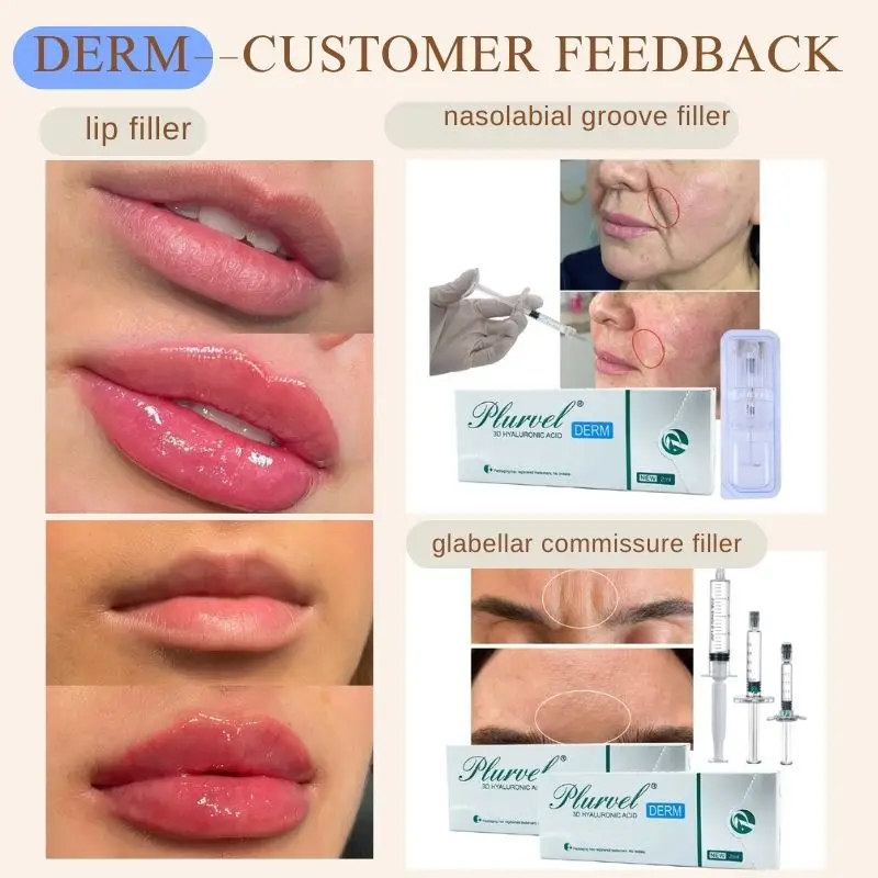 Plurvel Hyaluronic Acid 2ml 24mg/ml Pure Lips Dermal Filler Derm Injection With Needle And Lido For Lip