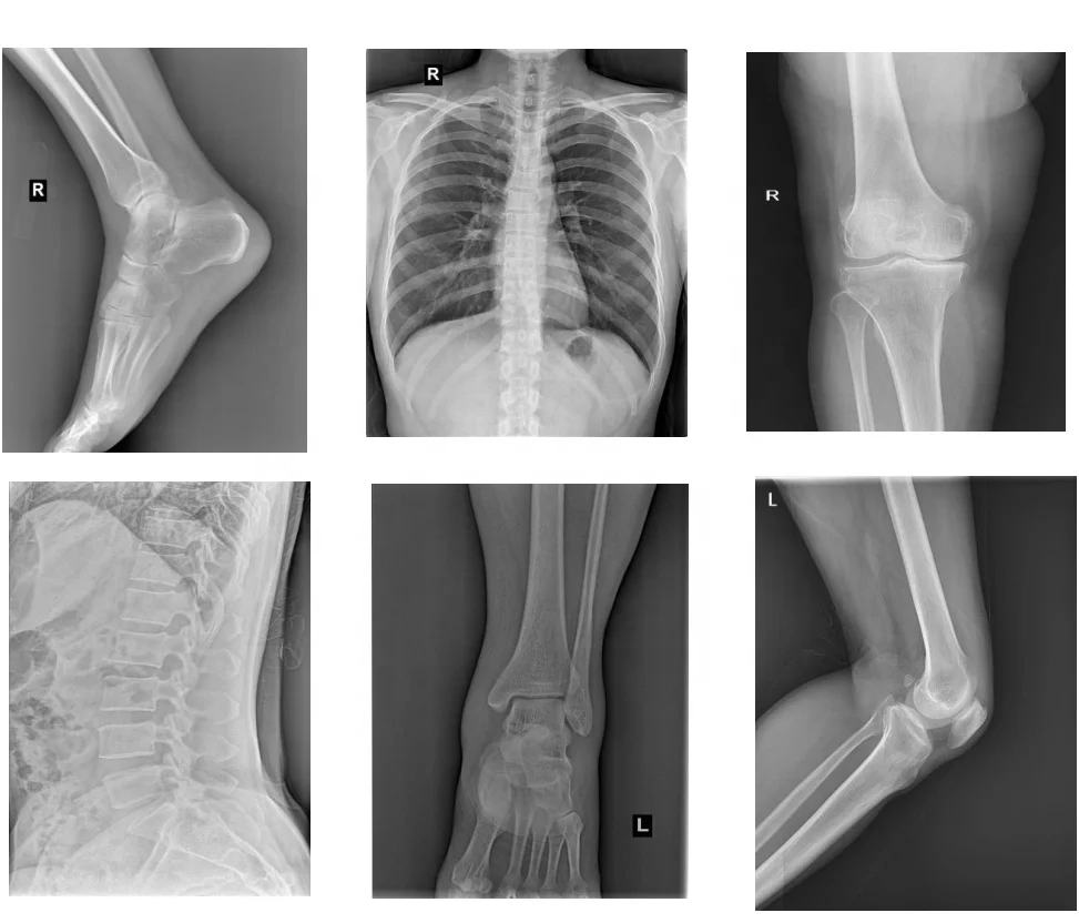 20/32/50KW X Ray Machine for Hospital/X-ray Equipment Medical Diagnostic X-Ray Machine Xray Digit