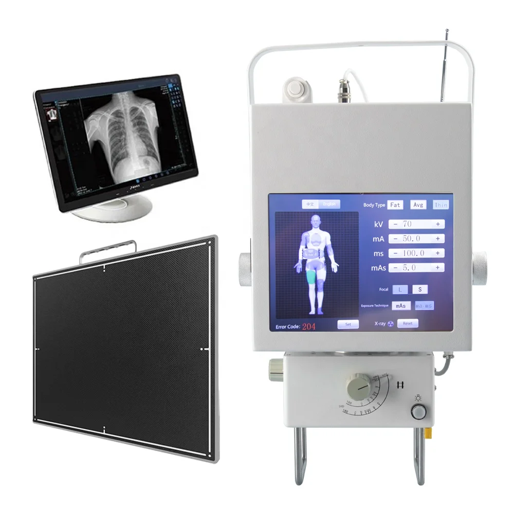 Medical Touch Screen Portable Digital X Ray Machine 5.3kw Mobile DR Digital Human X Ray Machine
