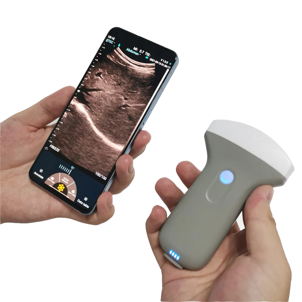 Hacemey veterinary portable ultrasound scanner wireless doppler ultrasound probe pregnancy scanner ultrasound for hospital